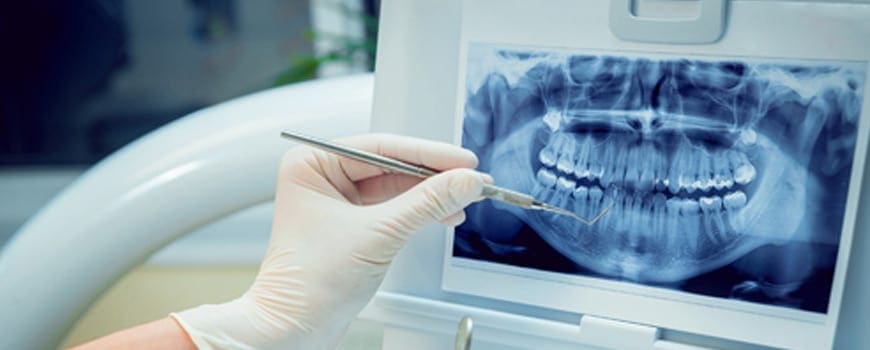 SACM Dentist Brisbane Dentist Xrays