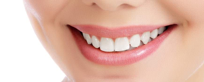 White Teeth Brisbane Dentist Spring Hill