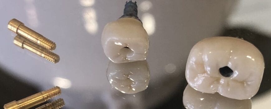 Implant teeth and crowns